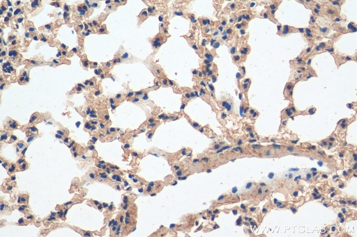 [28378-1-AP-150UL] Integrin beta-6 Polyclonal antibody