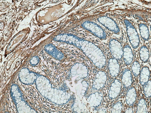 [28382-1-AP-20UL] Collagen Type V Polyclonal antibody