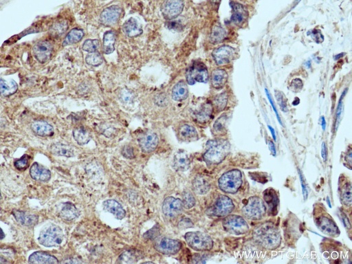 [28384-1-AP-20UL] UPF1 Polyclonal antibody