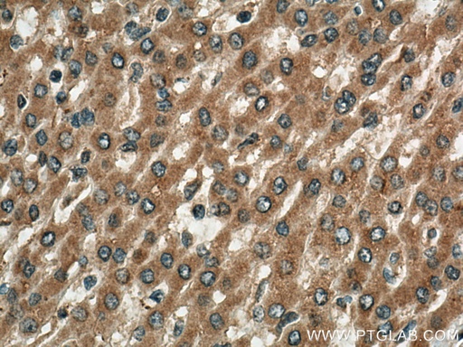 [28397-1-AP-150UL] TBK1 Polyclonal antibody