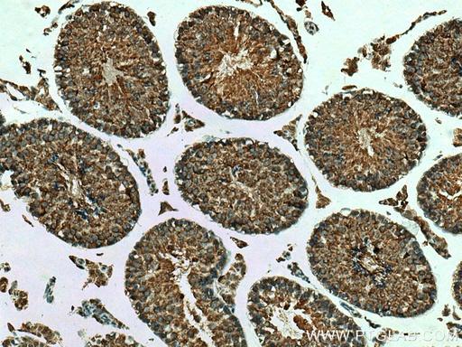 [28400-1-AP-20UL] MSTO1 Polyclonal antibody