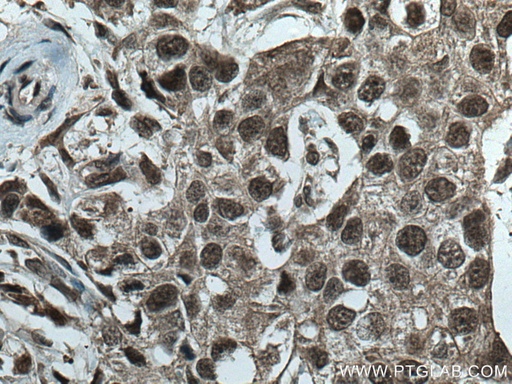 [28404-1-AP-20UL] CUL1 Polyclonal antibody