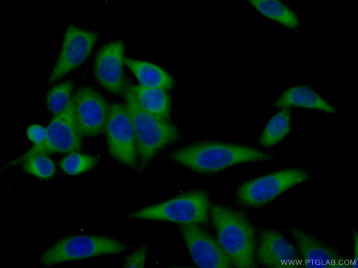 [28409-1-AP-150UL] ARHGAP18 Polyclonal antibody