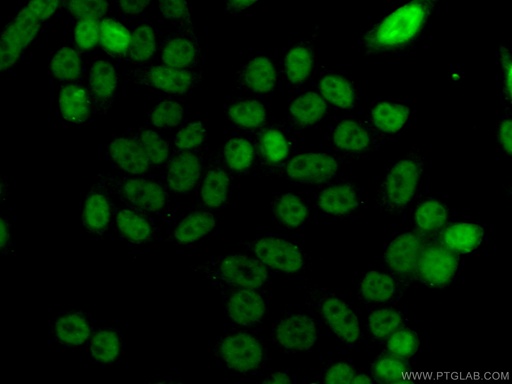 [28417-1-AP-150UL] TH1L Polyclonal antibody