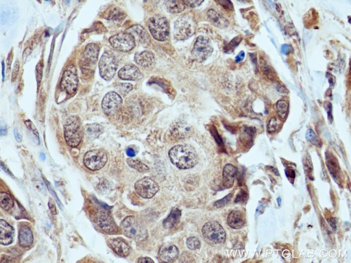 [28424-1-AP-20UL] FBXW7 Polyclonal antibody