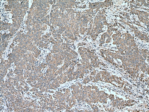 [28429-1-AP-150UL] MMP17 Polyclonal antibody