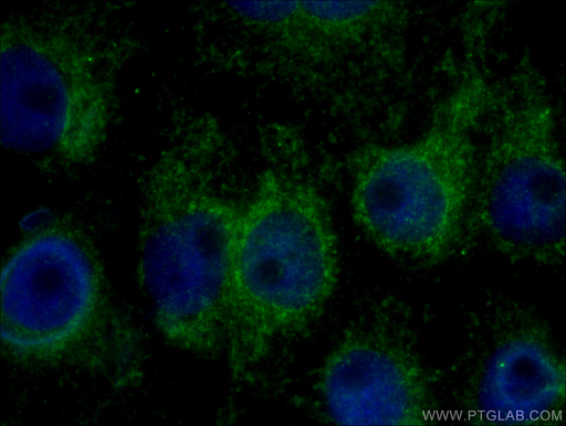 [28438-1-AP-150UL] DST Polyclonal antibody