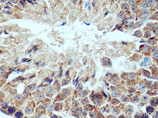 [28441-1-AP-20UL] IFT172 Polyclonal antibody