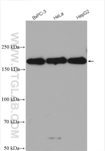 [28452-1-AP-20UL] RNF160 Polyclonal antibody
