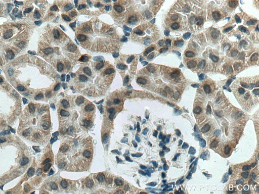 [28454-1-AP-20UL] SGK1 Polyclonal antibody