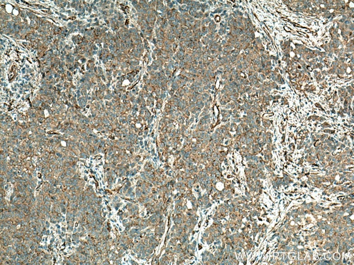[28477-1-AP-150UL] TPM1 Polyclonal antibody