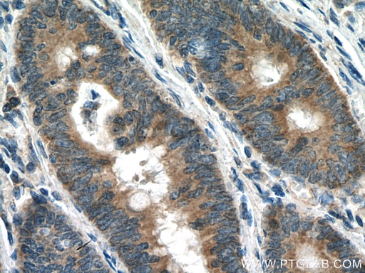 [28483-1-AP-150UL] CARD11 Polyclonal antibody