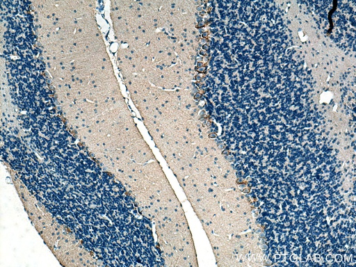 [28488-1-AP-20UL] GAT1 Polyclonal antibody