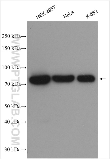 [28502-1-AP-150UL] DDX18 Polyclonal antibody