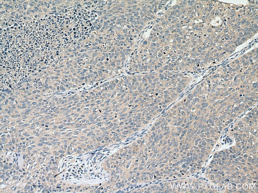 [28511-1-AP-20UL] PIEZO1 (extracellular domain) Polyclonal antibody