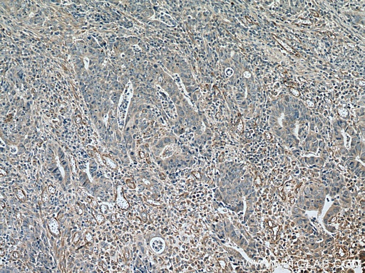 [28513-1-AP-150UL] TYRO3 Polyclonal antibody