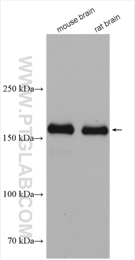 [28525-1-AP-150UL] NMDAR2A/GRIN2A Polyclonal antibody