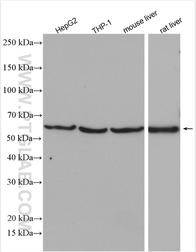 [28549-1-AP-150UL] Alpha-2-antiplasmin Polyclonal antibody