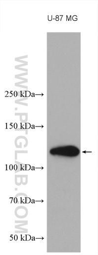 [28580-1-AP-150UL] NOTCH2 Polyclonal antibody