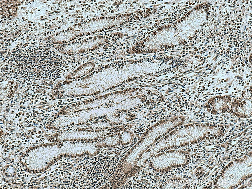 [28587-1-AP-20UL] KIF23 Polyclonal antibody