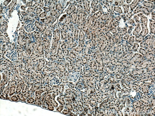[28608-1-AP-150UL] ZBTB8OS Polyclonal antibody
