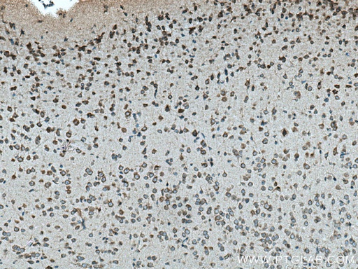 [28618-1-AP-150UL] VPS13A Polyclonal antibody