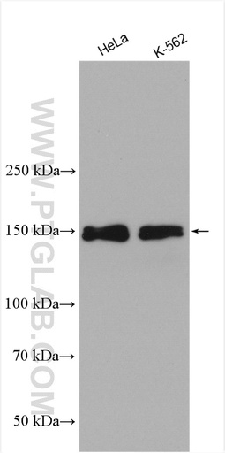 [28619-1-AP-20UL] FANCD2 Polyclonal antibody