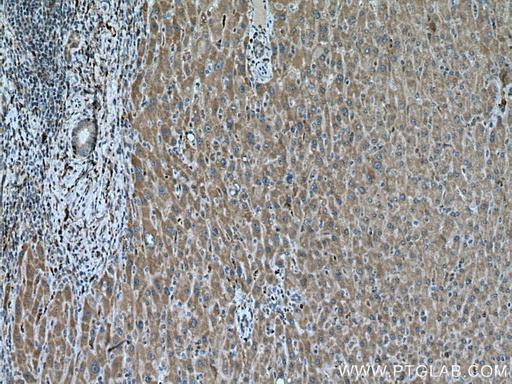 [28622-1-AP-20UL] BCAT1 Polyclonal antibody