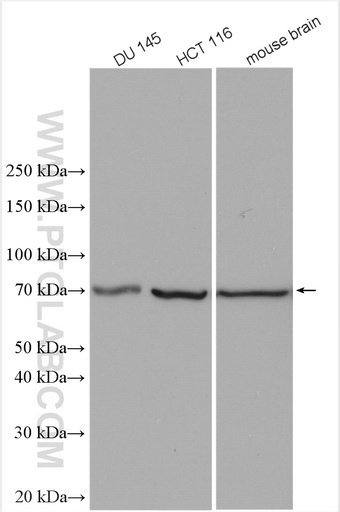 [28630-1-AP-20UL] TCTN1 Polyclonal antibody