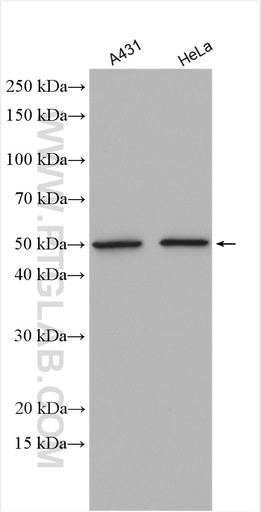 [28657-1-AP-150UL] ATF4 Polyclonal antibody