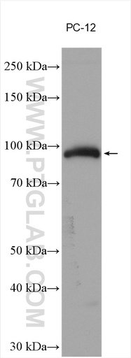 [28663-1-AP-150UL] Chromogranin B Polyclonal antibody