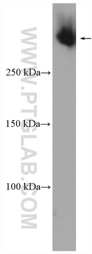 [28676-1-AP-20UL] VPS13C Polyclonal antibody