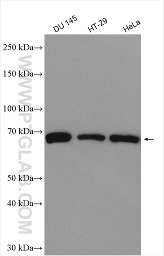 [28682-1-AP-150UL] TRABD2B Polyclonal antibody