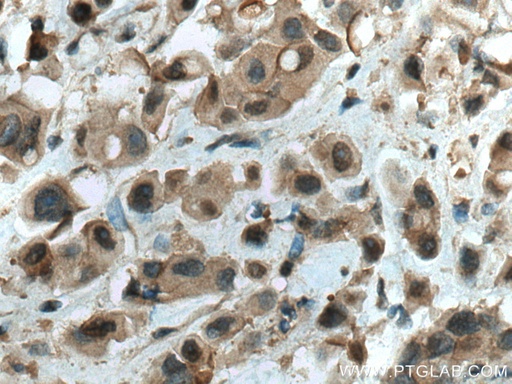 [28689-1-AP-150UL] WWP1 Polyclonal antibody