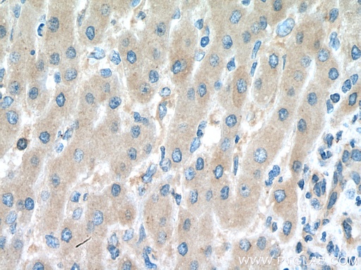 [28718-1-AP-20UL] SMCR7/MID49 Polyclonal antibody