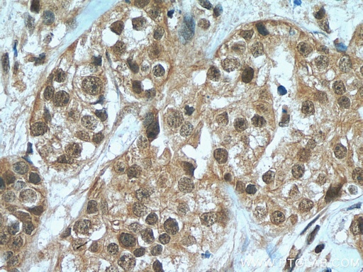 [28719-1-AP-150UL] HORMAD1 Polyclonal antibody