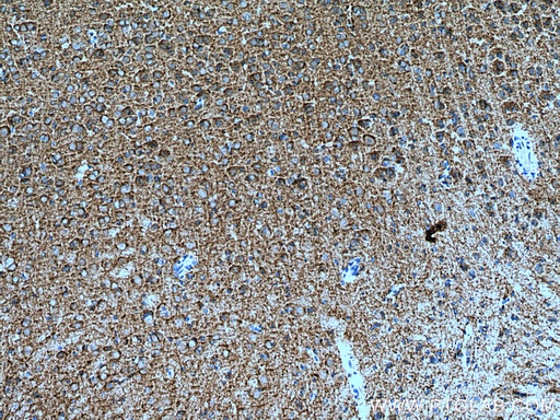 [28724-1-AP-150UL] KCC2/SLC12A5 Polyclonal antibody