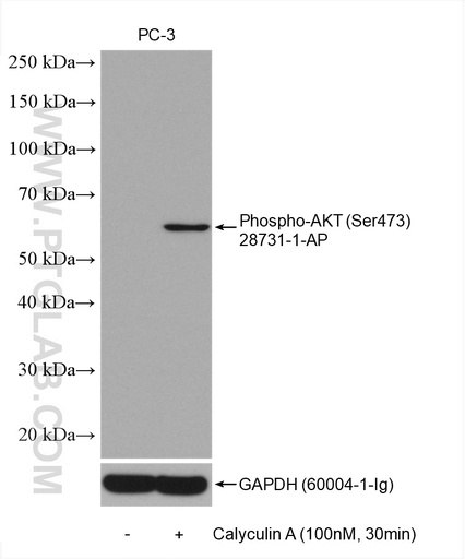 [28731-1-AP-100UL] Phospho-AKT (Ser473) Polyclonal antibody