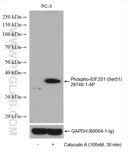 [28740-1-AP-100UL] Phospho-EIF2S1 (Ser51) Polyclonal antibody