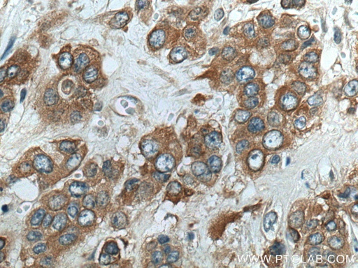 [28751-1-AP-20UL] TRIM27 Polyclonal antibody