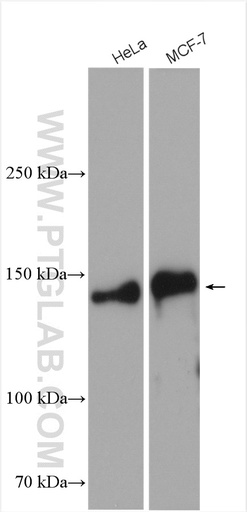 [28753-1-AP-20UL] TRPS1 Polyclonal antibody