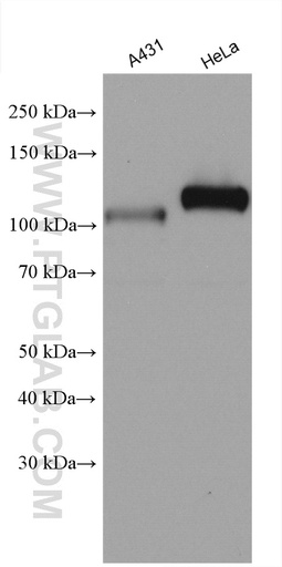 [28770-1-AP-150UL] KAT2B Polyclonal antibody
