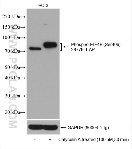 [28779-1-AP-20UL] Phospho-EIF4B (Ser406) Polyclonal antibody