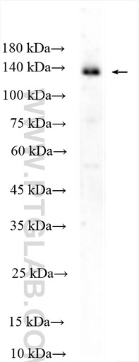 [28817-1-AP-150UL] USP25 Polyclonal antibody