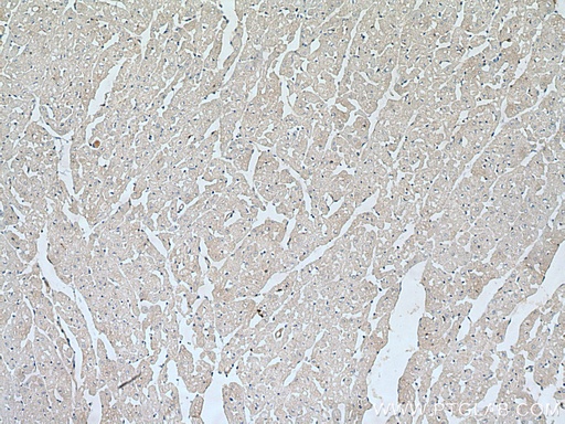 [28820-1-AP-20UL] WIPI2 Polyclonal antibody