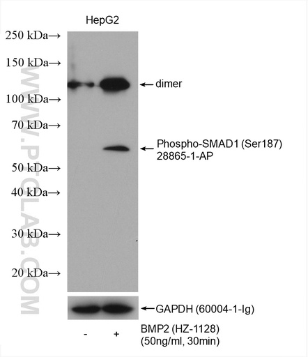[28865-1-AP-100UL] Phospho-SMAD1 (Ser187) Polyclonal antibody