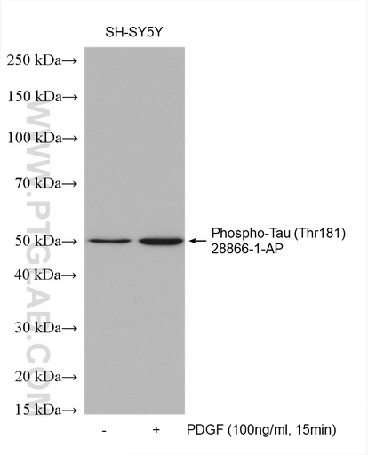 [28866-1-AP-20UL] Phospho-Tau (Thr181) Polyclonal antibody