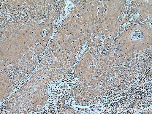 [28883-1-AP-20UL] CORO2A Polyclonal antibody