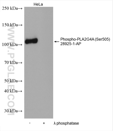 [28925-1-AP-100UL] Phospho-PLA2G4A (Ser505) Polyclonal antibody