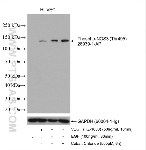 [28939-1-AP-100UL] Phospho-NOS3 (Thr495) Polyclonal antibody